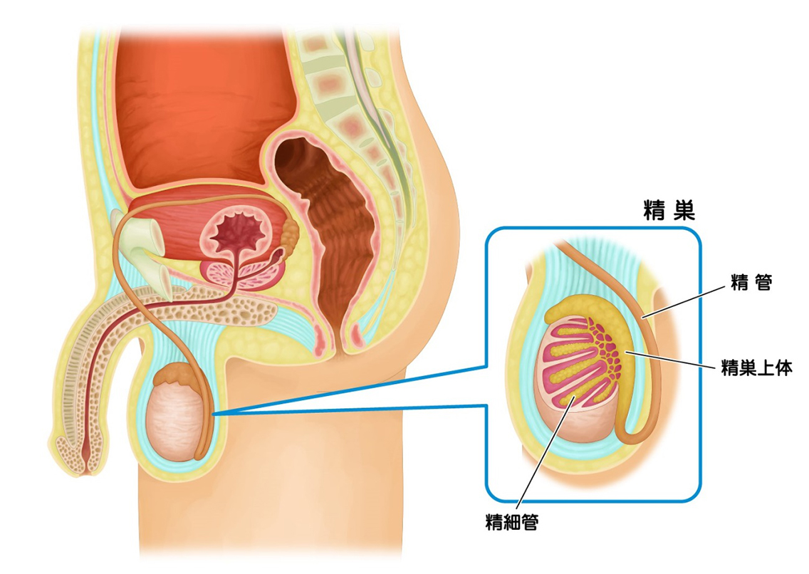超音波検査