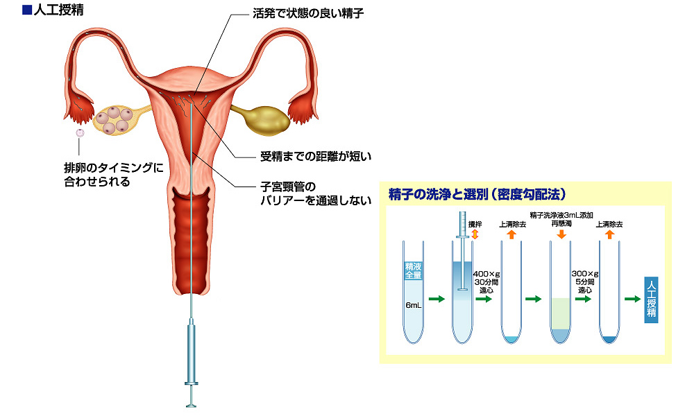 卵子 に たどり着く 時間 人工 授精